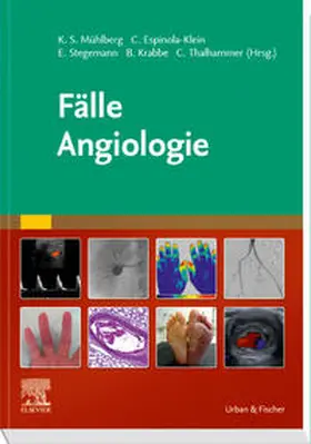 Mühlberg / Espinola-Klein / Krabbe | Fälle Angiologie | Buch | 978-3-437-23271-8 | sack.de
