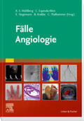 Mühlberg / Espinola-Klein / Stegemann |  Fälle Angiologie | Buch |  Sack Fachmedien