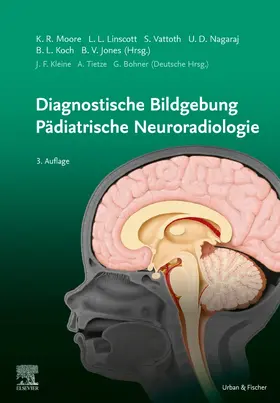 Moore | Diagnostische Bildgebung Pädiatrische Neuroradiologie | Buch | 978-3-437-23715-7 | sack.de