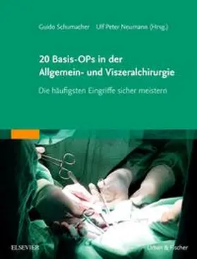 Schumacher / Neumann |  20 Basis-OPs in der Allgemein- und Viszeralchirurgie | Buch |  Sack Fachmedien