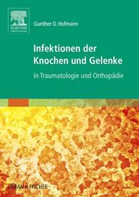 Hofmann |  Infektionen der Knochen und Gelenke | Buch |  Sack Fachmedien