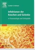 Hofmann |  Infektionen der Knochen und Gelenke | Buch |  Sack Fachmedien