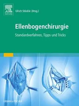 Stöckle |  Ellenbogenchirurgie | Buch |  Sack Fachmedien