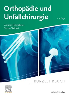 Ficklscherer / Weidert | Kurzlehrbuch Orthopädie und Unfallchirurgie | Buch | 978-3-437-41189-2 | sack.de