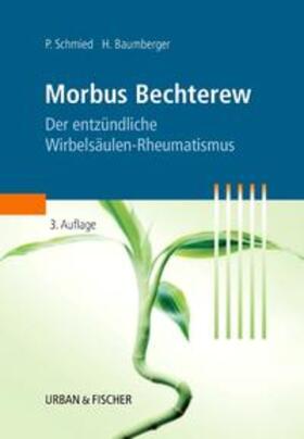 Baumberger / Schmied | Morbus Bechterew | Buch | sack.de