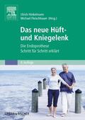 Fleischhauer / Hinkelmann |  Das neue Hüft- und Kniegelenk | Buch |  Sack Fachmedien
