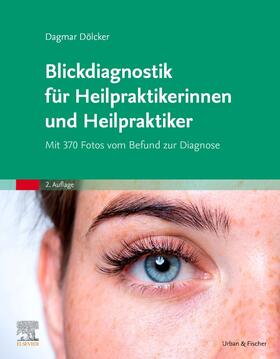 Dölcker |  Blickdiagnostik für Heilpraktikerinnen und Heilpraktiker | Buch |  Sack Fachmedien