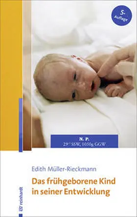 Müller-Rieckmann |  Das frühgeborene Kind in seiner Entwicklung | Buch |  Sack Fachmedien