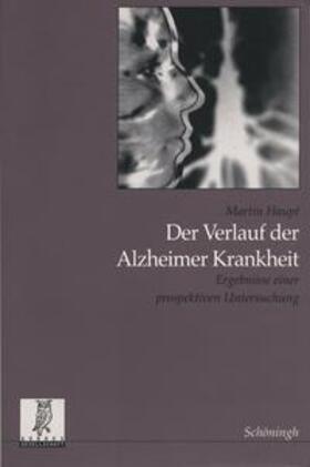 Haupt | Der Verlauf der Alzheimer Krankheit | Buch | 978-3-506-72842-5 | sack.de