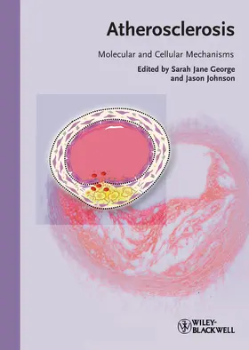 George / Johnson |  Atherosclerosis | Buch |  Sack Fachmedien