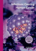 zur Hausen |  Infections Causing Human Cancer | Buch |  Sack Fachmedien