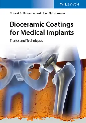 Heimann / Lehmann |  Bioceramic Coatings for Medical Implants | Buch |  Sack Fachmedien