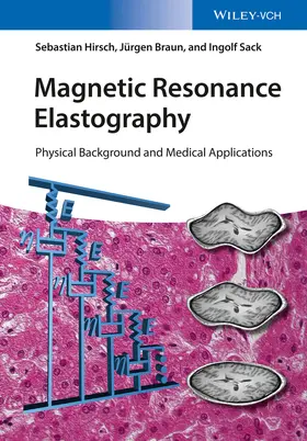 Hirsch / Braun / Sack |  Magnetic Resonance Elastography | Buch |  Sack Fachmedien
