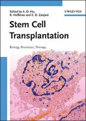 Ho / Hoffman / Zanjani |  Stem Cell Transplantation | eBook | Sack Fachmedien