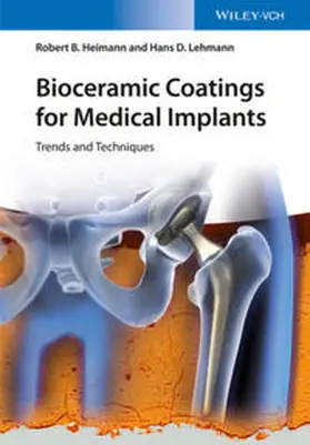 Heimann / Lehmann |  Bioceramic Coatings for Medical Implants | eBook | Sack Fachmedien