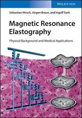 Hirsch / Braun / Sack |  Magnetic Resonance Elastography | eBook | Sack Fachmedien
