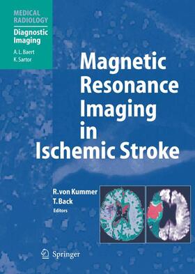 von Kummer / Back | Magnetic Resonance Imaging in Ischemic Stroke | Buch | 978-3-540-00861-3 | sack.de