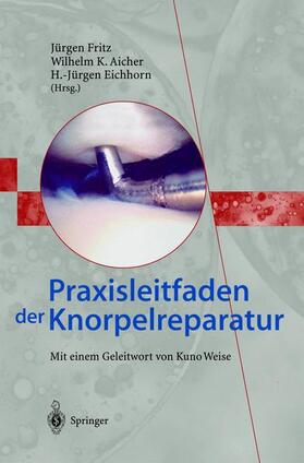 Fritz / Eichhorn / Aicher | Praxisleitfaden der Knorpelreparatur | Buch | 978-3-540-01029-6 | sack.de