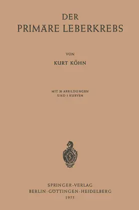 Köhn |  Der Primäre Leberkrebs | Buch |  Sack Fachmedien