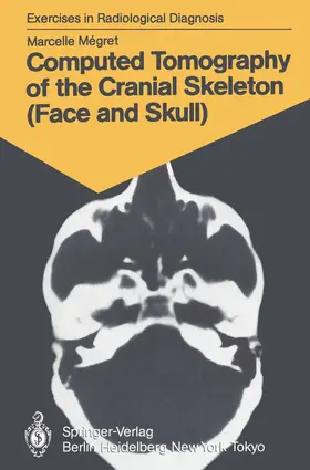 Megret |  Computed Tomography of the Cranial Skeleton (Face and Skull) | Buch |  Sack Fachmedien