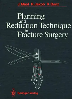 Mast / Jakob / Ganz |  Planning and Reduction Technique in Fracture Surgery | Buch |  Sack Fachmedien