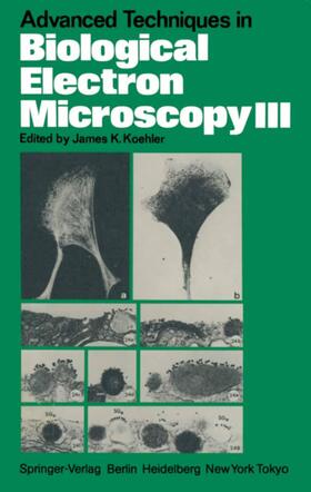 Koehler | Advanced Techniques in Biological Electron Microscopy III | Buch | 978-3-540-16400-5 | sack.de