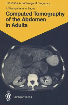 Wackenheim / Badoz |  Computed Tomography of the Abdomen in Adults | Buch |  Sack Fachmedien