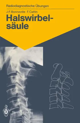 Bonneville / Cattin |  Halswirbelsäule | Buch |  Sack Fachmedien