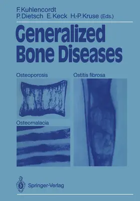 Kuhlencordt / Dietsch / Keck |  Generalized Bone Diseases | Buch |  Sack Fachmedien