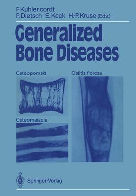 Kuhlencordt / Kruse / Dietsch | Generalized Bone Diseases | Buch | 978-3-540-18789-9 | sack.de