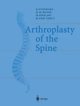 Gunzburg / Aebi / Mayer |  Arthroplasty of the Spine | Buch |  Sack Fachmedien