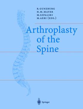 Gunzburg / Aebi / Mayer | Arthroplasty of the Spine | Buch | 978-3-540-20295-0 | sack.de