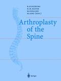 Gunzburg / Aebi / Mayer |  Arthroplasty of the Spine | Buch |  Sack Fachmedien