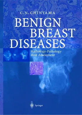 Chinyama | Benign Breast Diseases | Buch | 978-3-540-20472-5 | www.sack.de