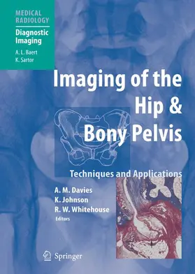 Davies / Johnson / Whitehouse |  Imaging of the Hip & Bony Pelvis | Buch |  Sack Fachmedien