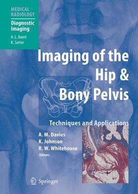 Davies / Whitehouse / Johnson | Imaging of the Hip & Bony Pelvis | Buch | 978-3-540-20640-8 | sack.de