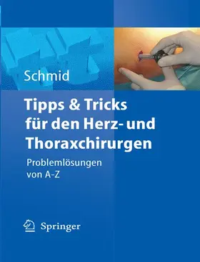 Schmid |  Tipps und Tricks für den Herz- und Thoraxchirurgen | Buch |  Sack Fachmedien