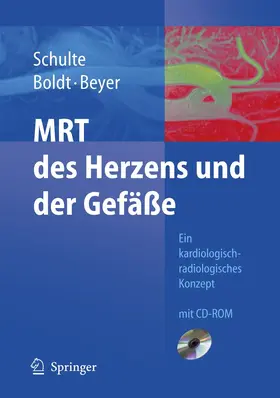 Schulte / Beyer / Boldt |  MRT des Herzens und der Gefäße | Buch |  Sack Fachmedien