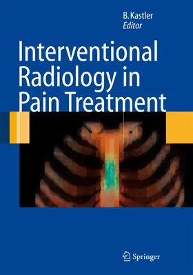 Kastler | Interventional Radiology in Pain Treatment | Buch | 978-3-540-24810-1 | www.sack.de