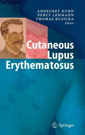 Kuhn / Lehmann / Ruzicka |  Cutaneous Lupus Erythematosus | eBook | Sack Fachmedien