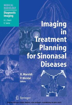 Maroldi / Nicolai | Imaging in Treatment Planning for Sinonasal Diseases | E-Book | sack.de