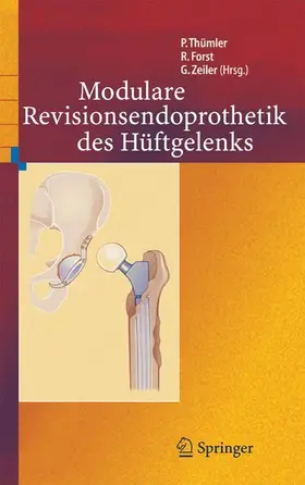 Thümler / Forst / Zeiler |  Modulare Revisionsendoprothetik des Hüftgelenks | eBook | Sack Fachmedien