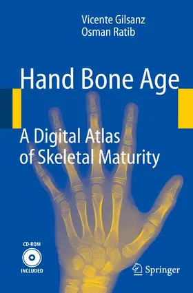 Gilsanz / Ratib |  Hand Bone Age | eBook | Sack Fachmedien