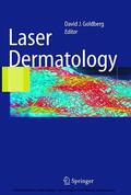 Goldberg |  Laser Dermatology | eBook | Sack Fachmedien