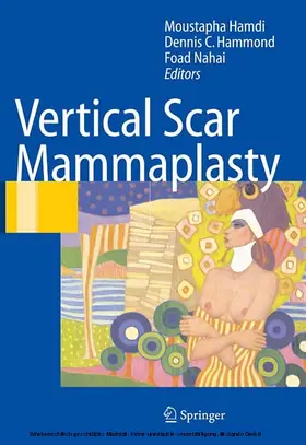 Hamdi / Hammond / Nahai |  Vertical Scar Mammaplasty | eBook | Sack Fachmedien