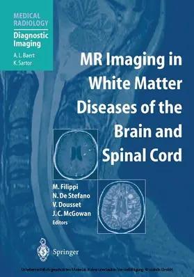 Filippi / de Stefano / Dousset |  MR Imaging in White Matter Diseases of the Brain and Spinal Cord | eBook | Sack Fachmedien