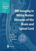 Filippi / de Stefano / Dousset |  MR Imaging in White Matter Diseases of the Brain and Spinal Cord | eBook | Sack Fachmedien