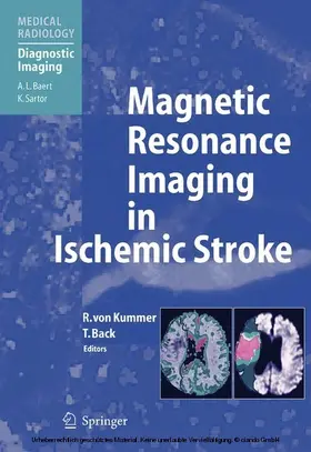 von Kummer / Back |  Magnetic Resonance Imaging in Ischemic Stroke | eBook | Sack Fachmedien