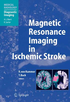 von Kummer / Back | Magnetic Resonance Imaging in Ischemic Stroke | E-Book | sack.de