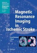 von Kummer / Back |  Magnetic Resonance Imaging in Ischemic Stroke | eBook | Sack Fachmedien